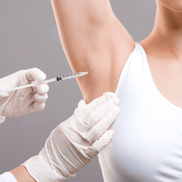 Dysport para Sudoración Excesiva 💧✨