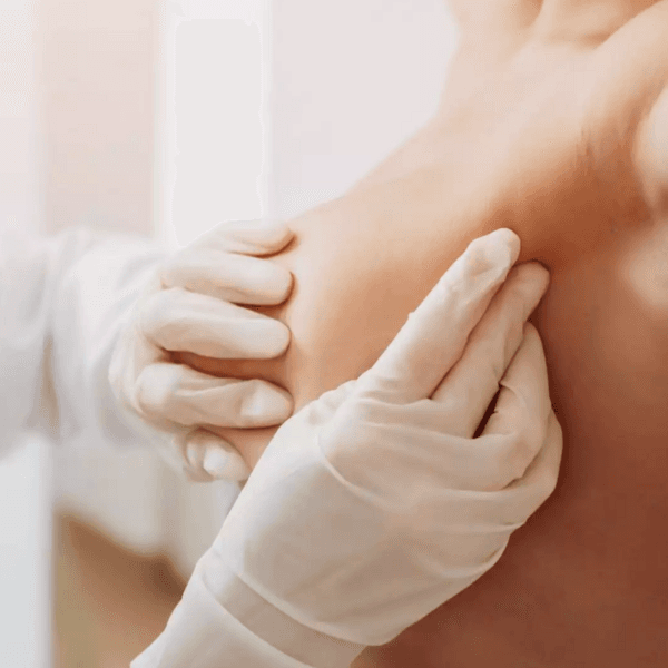 Postoperatorio Cirugía Plástica Mamas/Pectoral