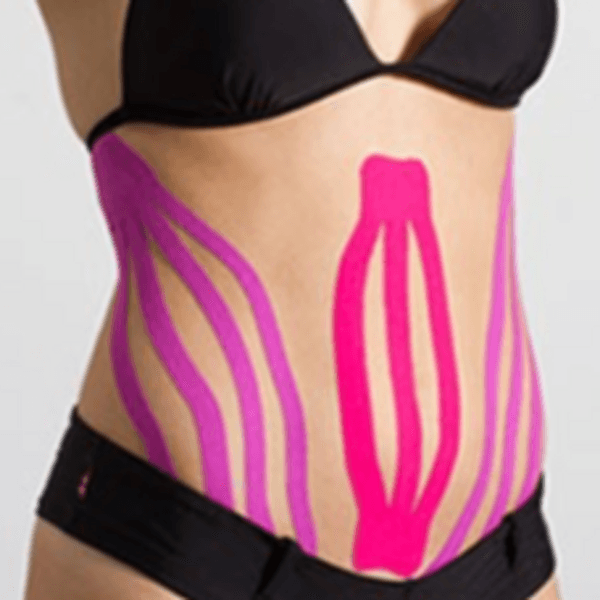 Postoperatorio Cirugía Plástica Corporal