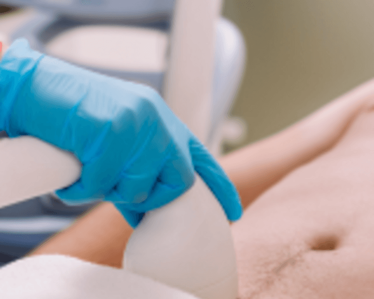 Depilación Definitiva Hombre - 4 zonas