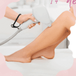 Operadora Depilación definitiva photo