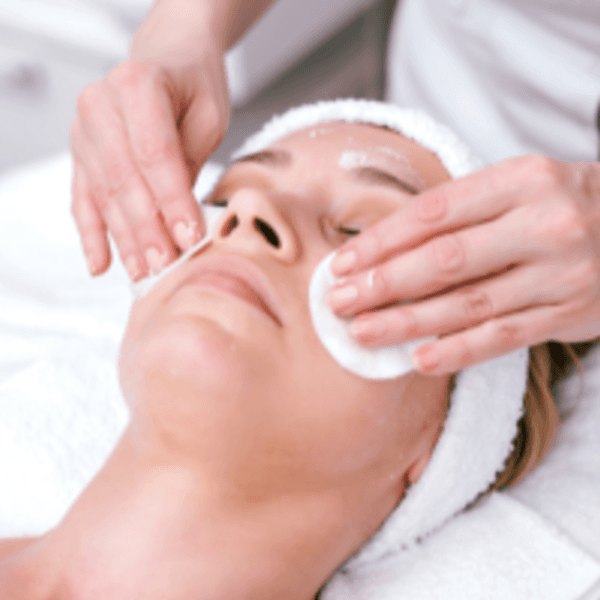 Higiene Profunda con peeling químico