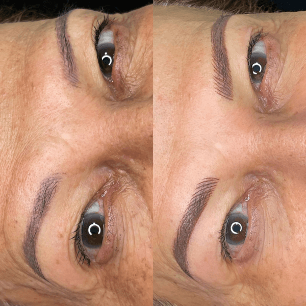 Micropigmentacion de cejas (Pacientes con PROCEDIMIENTO ANTERIOR O TATUAJE) *Todas las tecnicas*