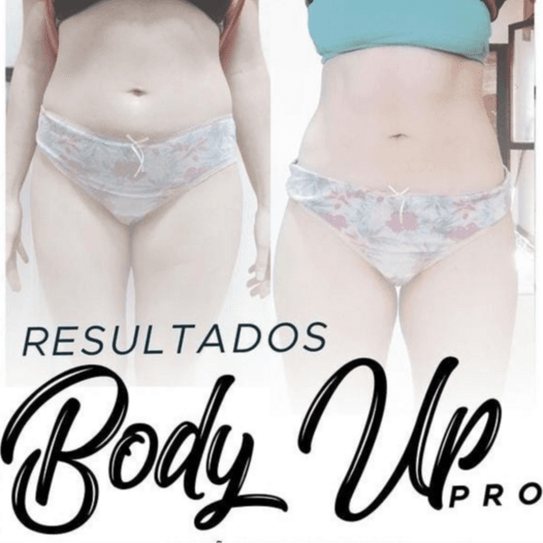 BODY X1 Y CRIORADIOFRECUENCIA X2