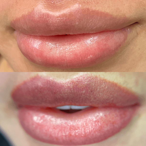 Micropigmentacion de Labios
