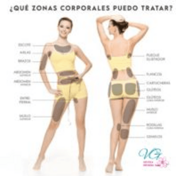 HIFU Abdomen y cintura