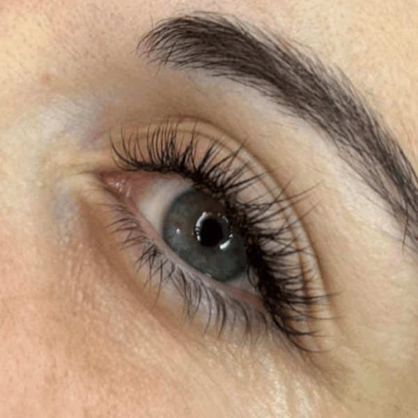 Extensiones clásicas