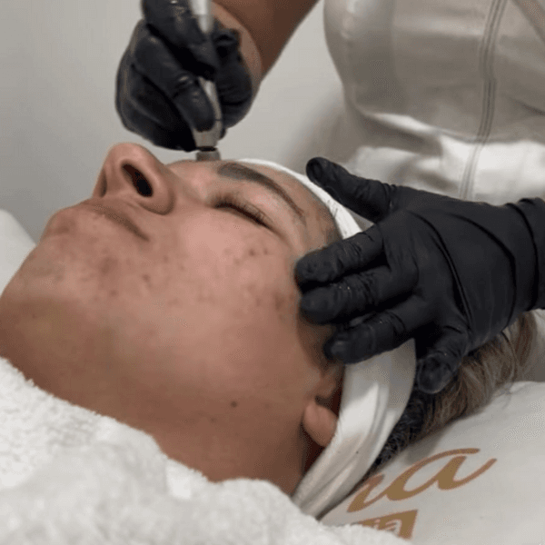 Higiene Facial Profunda