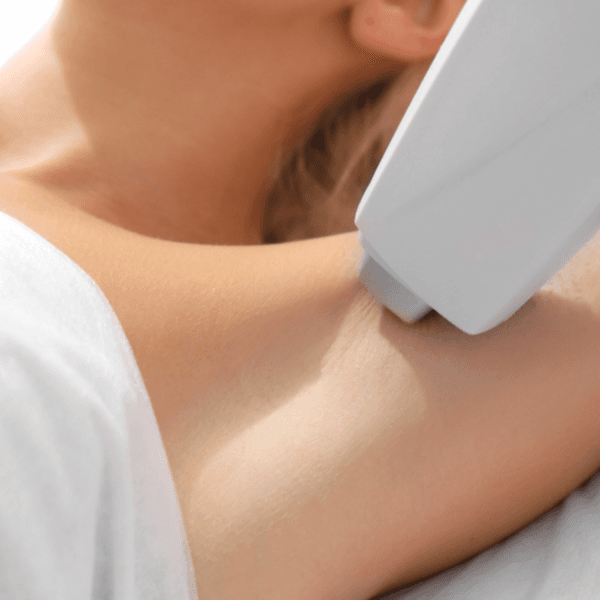 Depilación Trilaser