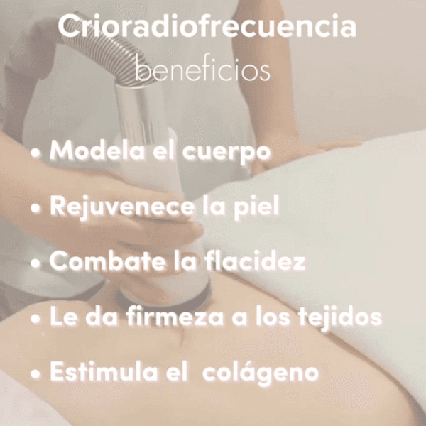 CRIORADIOFRECUENCIA 2 ZONAS