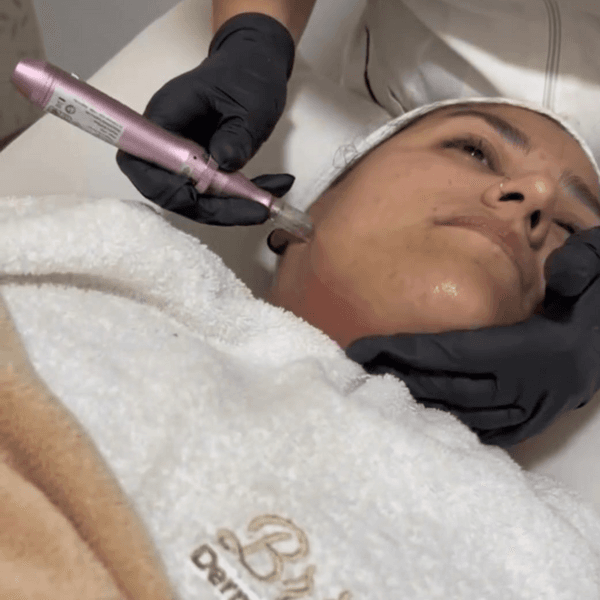 DERMAPEEL (PEELING+DERMAPEN)