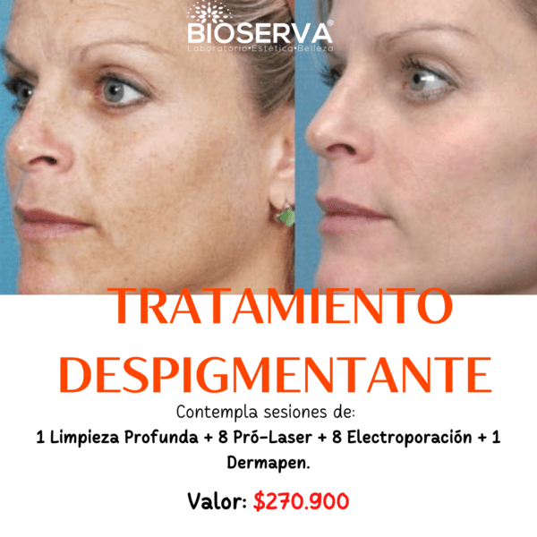 Tratamiento Despigmentante (1LP+8ProLáser+8EP+1Derm) 9 Sesiones