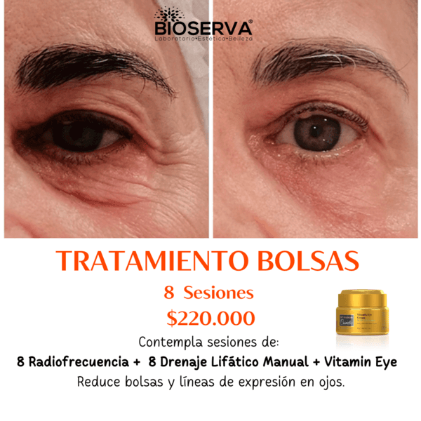 Tratamiento Bolsas Ojos (8 RF+8 DLM+ Vitamin Eye ) 8 Sesiones