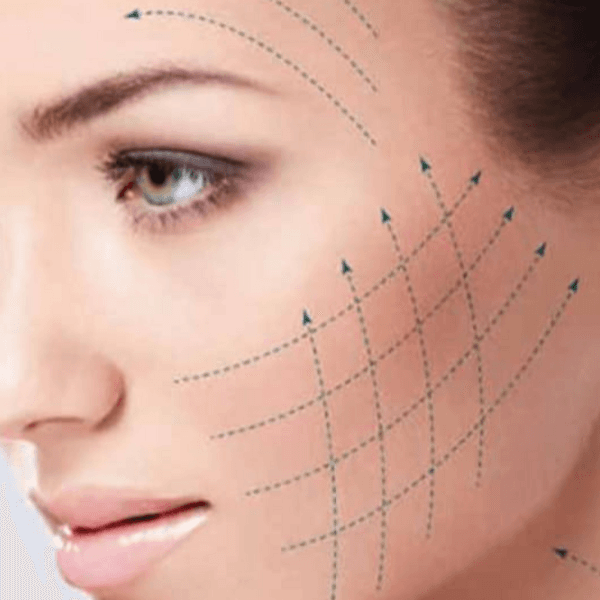 HILOS TENSORES Y PARCHES COSMETOLÓGICOS