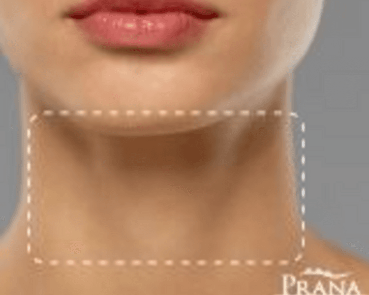 Depilación Láser Paquete Cuello