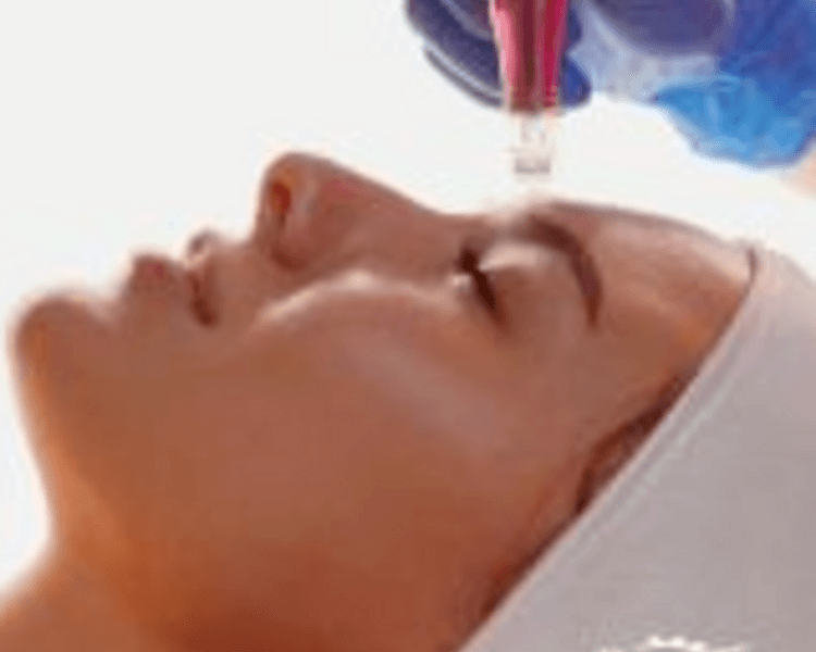 Facial Especializado IPL + Microneedling