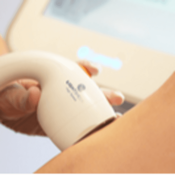 Depilación Axilas Mujer