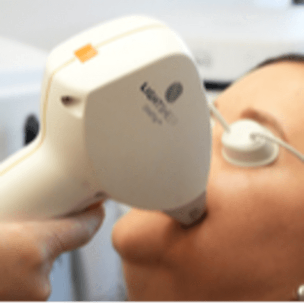 Depilación Cara Completa Mujer