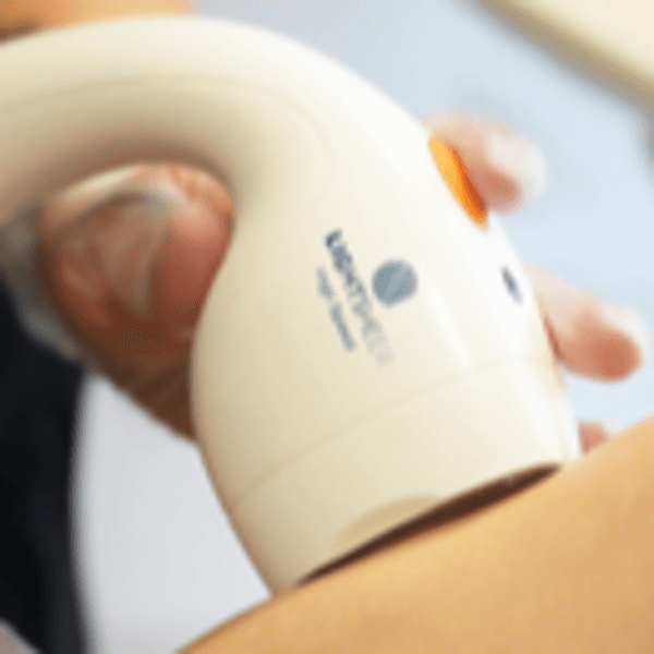 Depilación Cuello Mujer Posterior (Nuca)