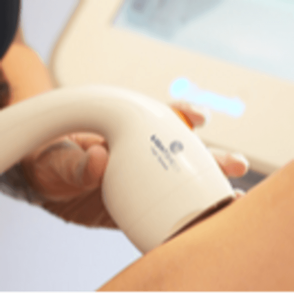 Depilación Frente Hombre