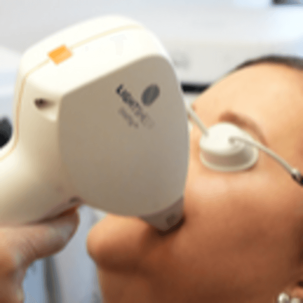 Depilación Mandibular Mujer