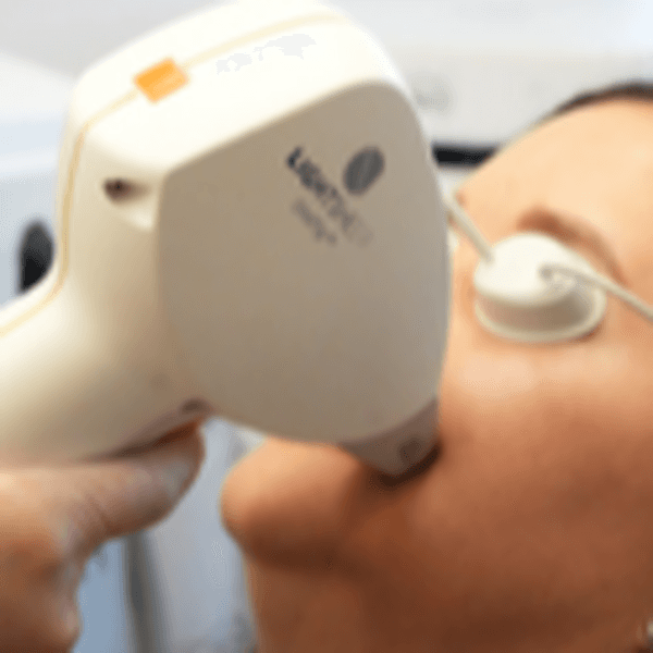 Depilación Mentón Mujeres