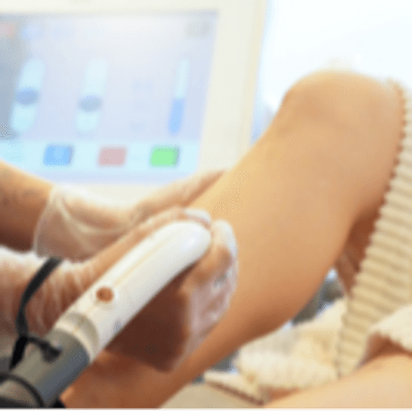 Depilación Muslo y Pierna Hombre