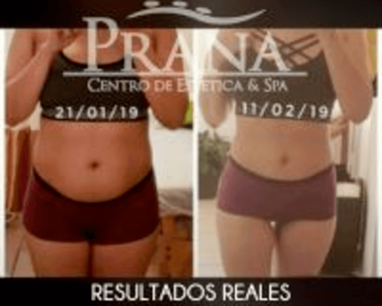 Programa de Restauración Post-Parto