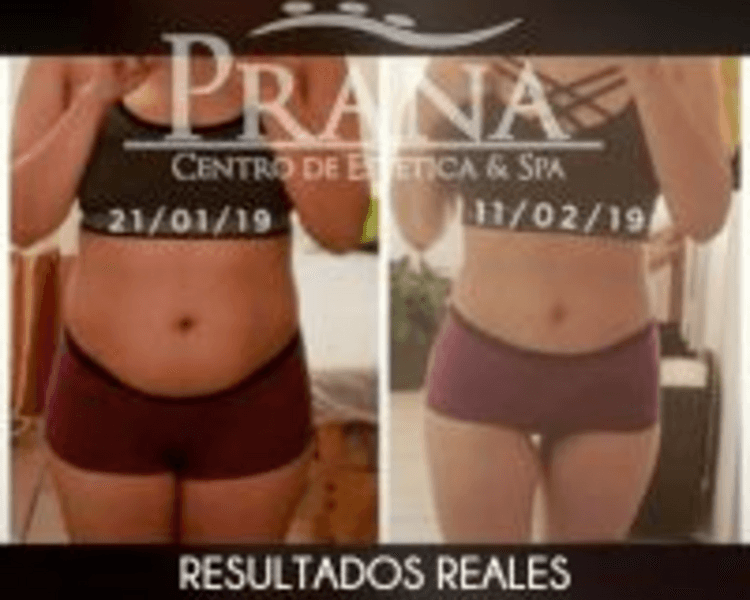 Tratamiento Corporal Post-Parto