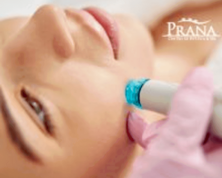 3- Hydra Facial