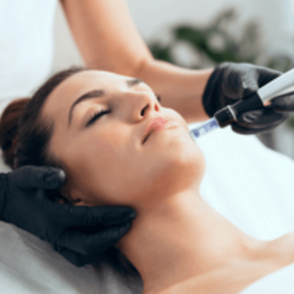 Microneedling