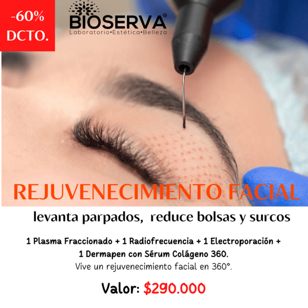 Rejuvenecimiento Facial ( 1 PF+1 RF+ 1 EP+ 1 Dermapen) Sesion