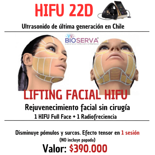 Hifu 22D Full Face 1 sesion + RF