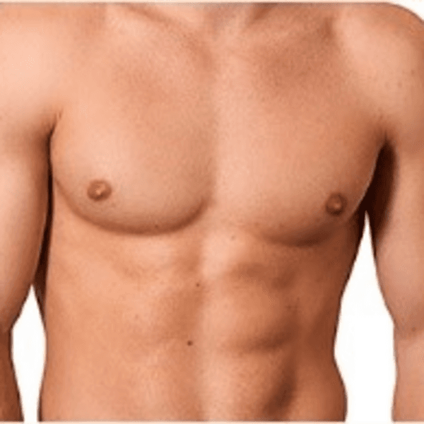 Torso Anterior Masculino 6 Sesiones