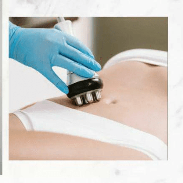 Radiofrecuencia Corporal- (Precio por zona) 1 sesión