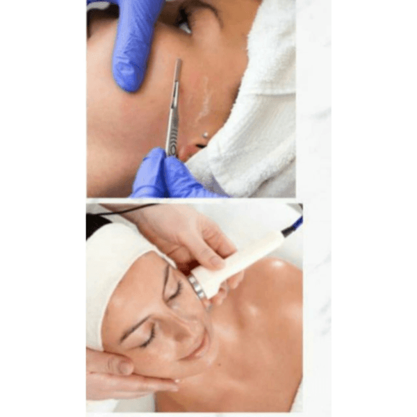 Higiene Prof. con Dermaplaning y Electroporacion
