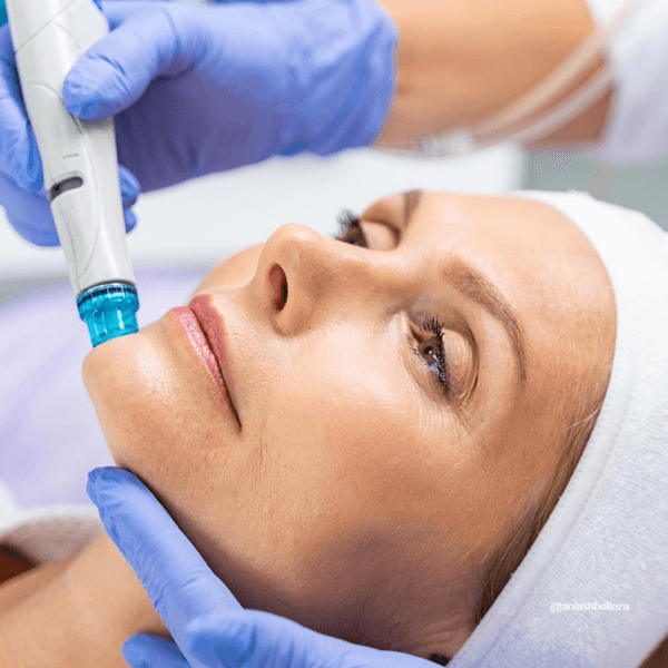 SKIN GLOW (LIMPIEZA FACIAL PROFUNDA + INCLUYE MICRO Y RADIO F)