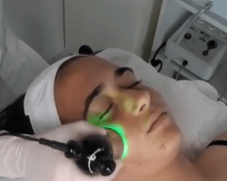 LIMPIEZA PROFUNDA + ELECTROPORACIÓN