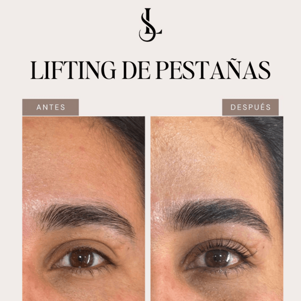 Lifting de pestañas