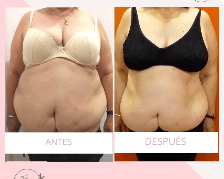 PASE LIBRE COMBINADO