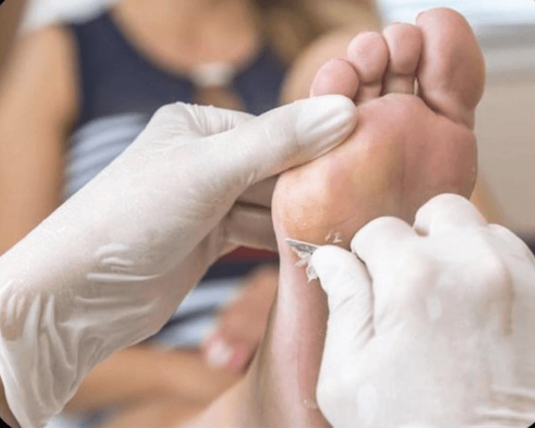 Podología estética con Esmaltado Semi permanente