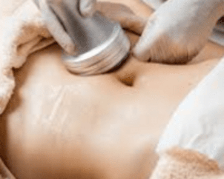 Tratamiento cosmetológicos corporales