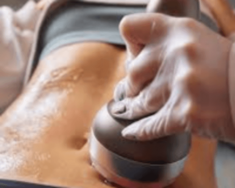 Radiofrecuencia Corporal