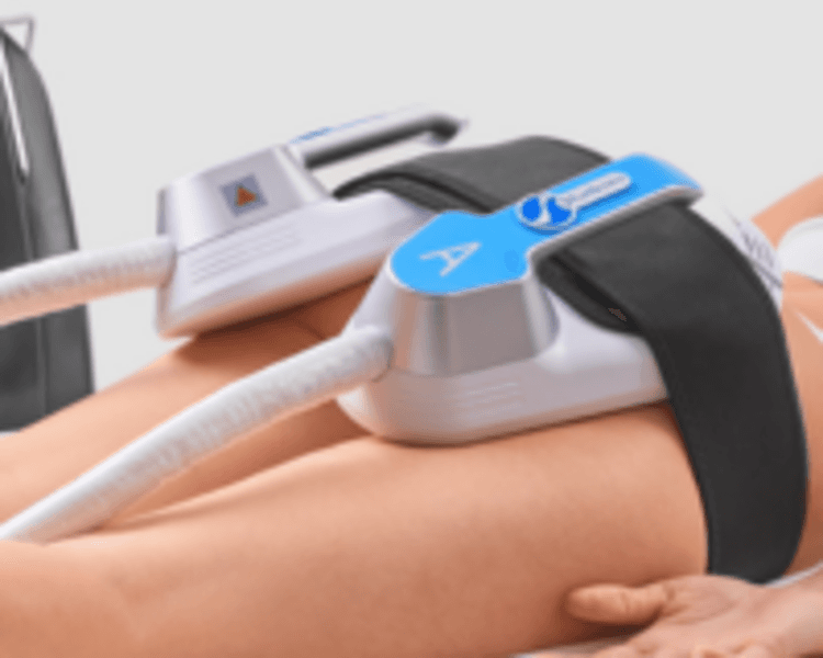 Mio Up promo 4 sesiones