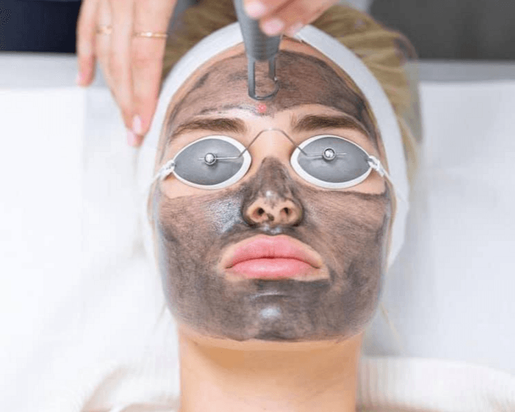 Hollywood Peel (Neatcell)