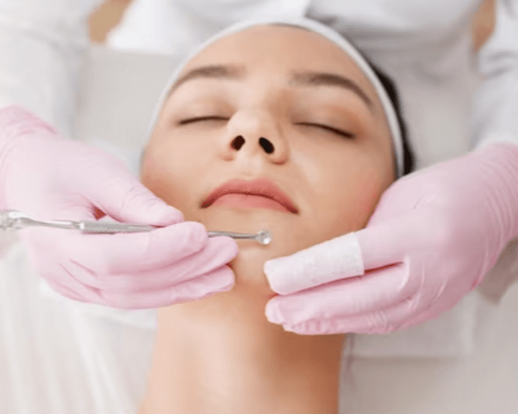 Limpieza Facial profunda con extracción de Puntos negros