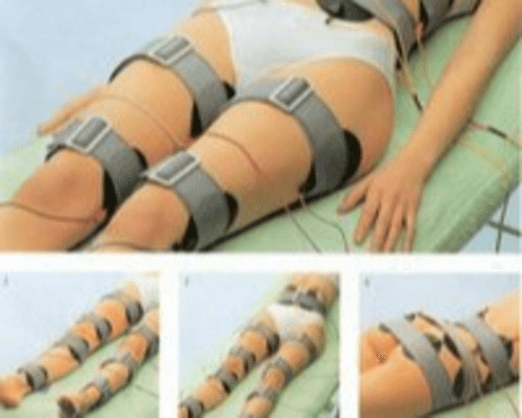 Ondas Rusas / Electrodos