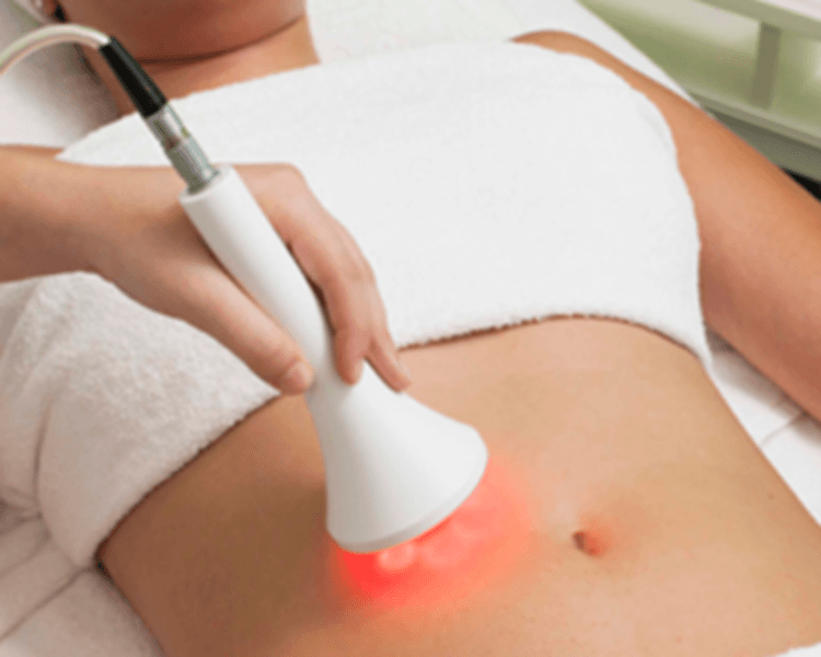 Electroporación / Mesoterapia sin inyección ( Flancos y Abdomen )