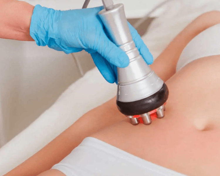 Pack Radiofrecuencia / 4 sesiones