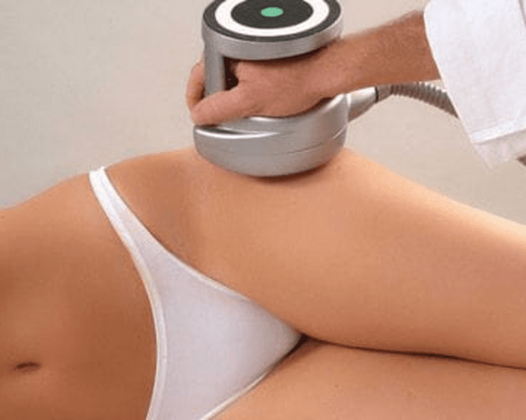 Ultracavitación ( Piernas )